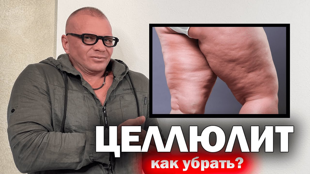 целлюлит на попе причины — ЦЕЛЛЮЛИТ НА ПОПЕ. ПРИЧИНЫ. КАК УБРАТЬ ЦЕЛЛЮЛИТ