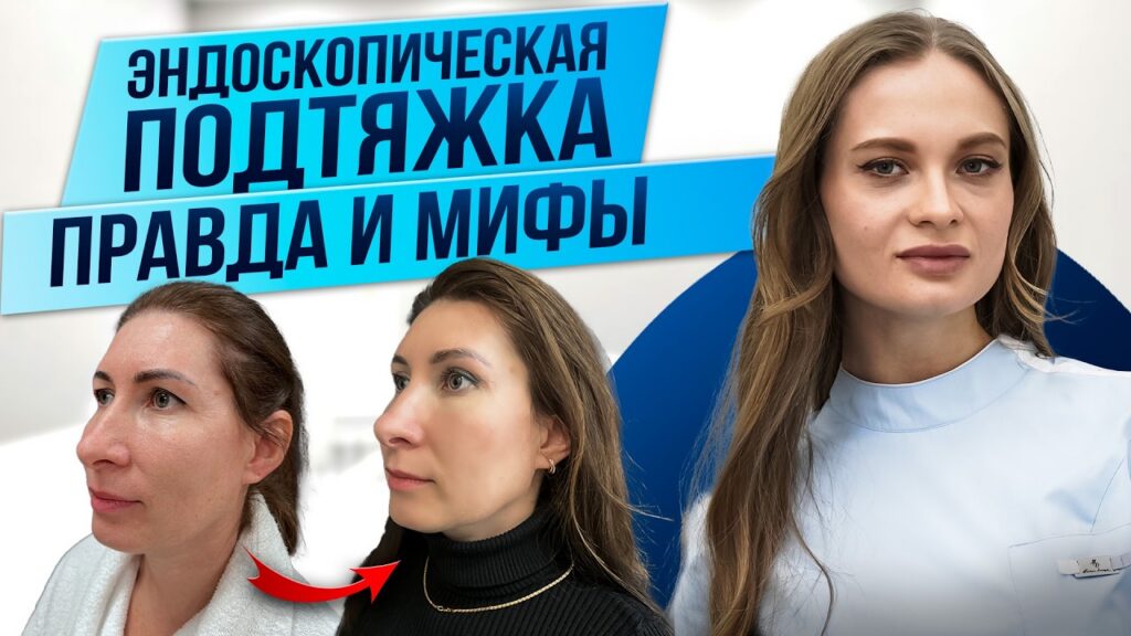 ЭНДОСКОПИЧЕСКАЯ ПОДТЯЖКА ЛИЦА | Преимущества операции
